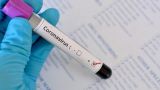 Еще двое человек заразились коронавирусом в Северной Осетии